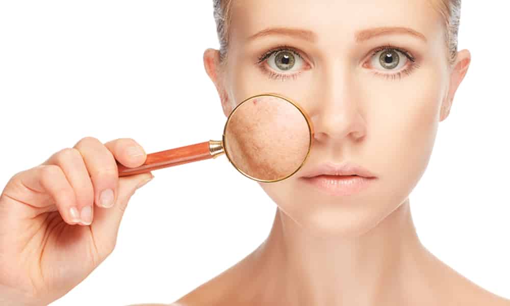 Pigmentation Laser Treatments for Clear Skin