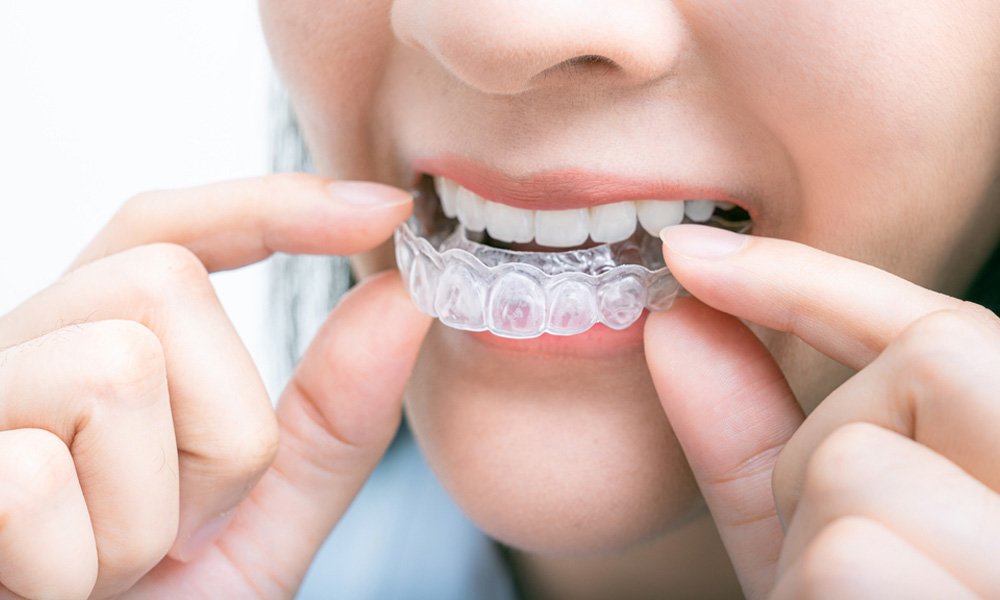 Invisalign Treatment