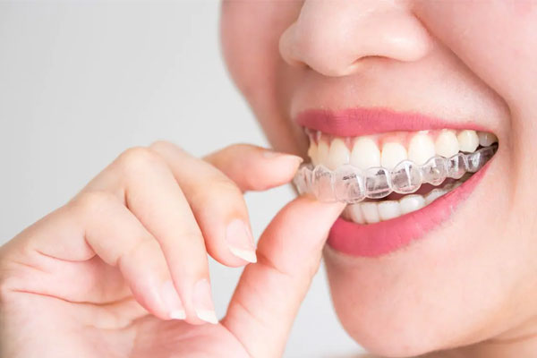 Invisalign Treatments