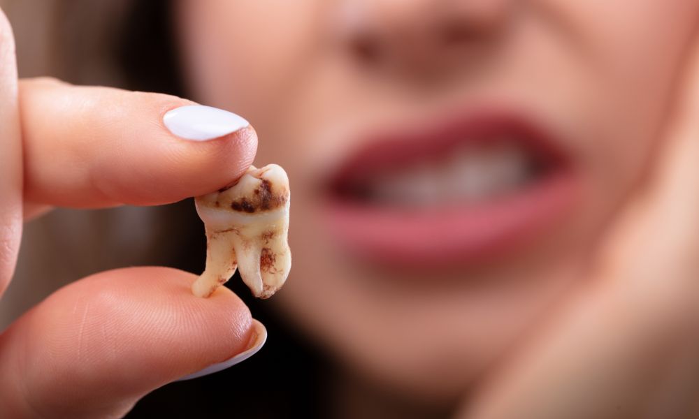 When Might You Need a Tooth Extraction in Montville, NJ?