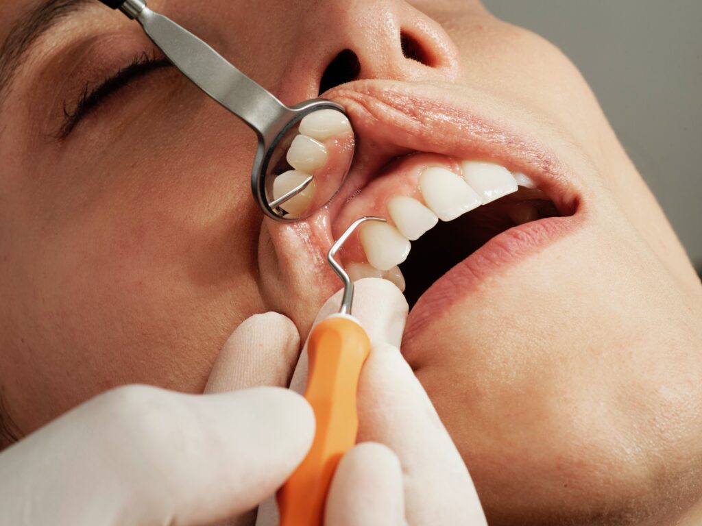 Top Tips for Maintaining Oral Hygiene Between Dental Visits