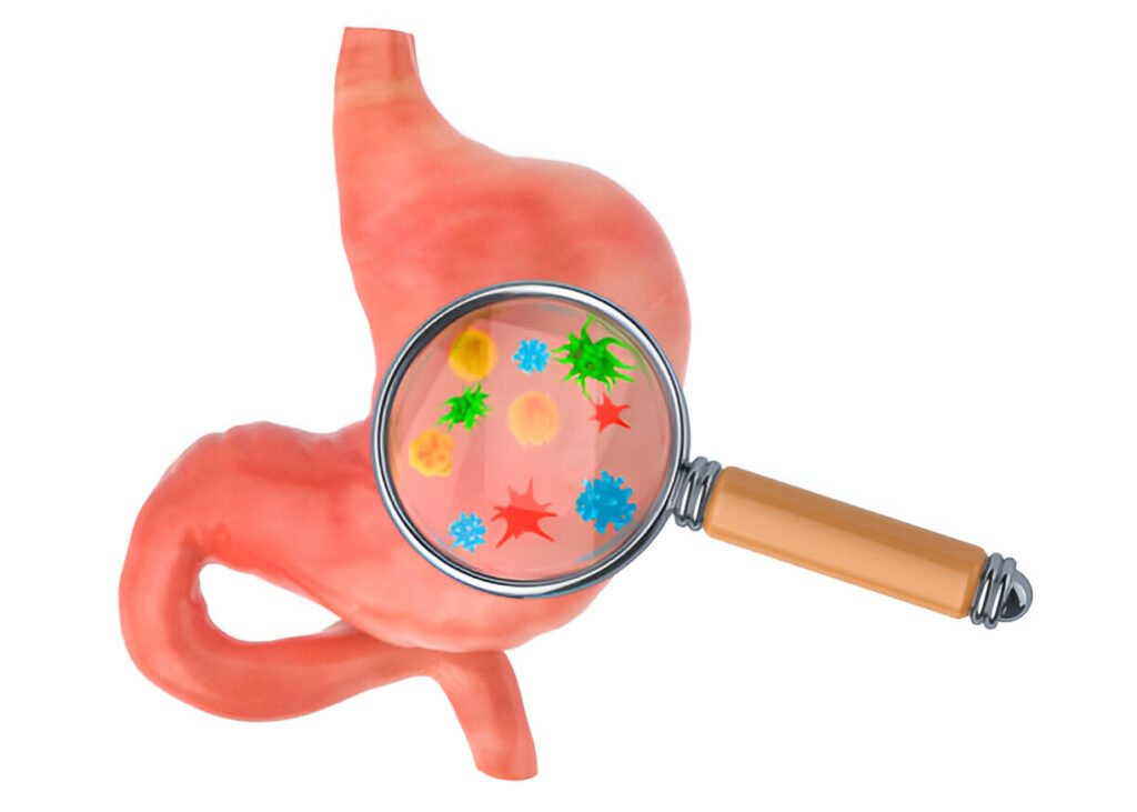 Can Home Remedies Actually Help in H.Pylori Treatment?